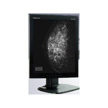 MMD-5201 - 20.1 " diagnostic grayscale monitor